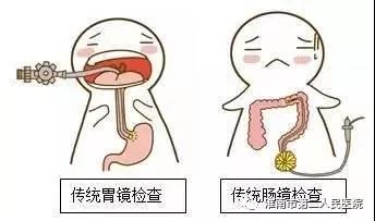 胃鏡